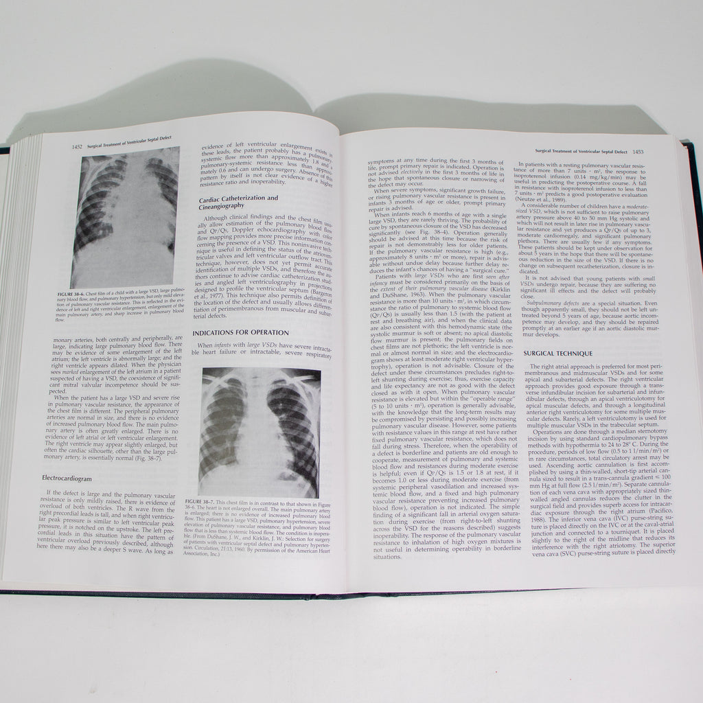 Surgery of the Chest, Sixth Edition, Volume II