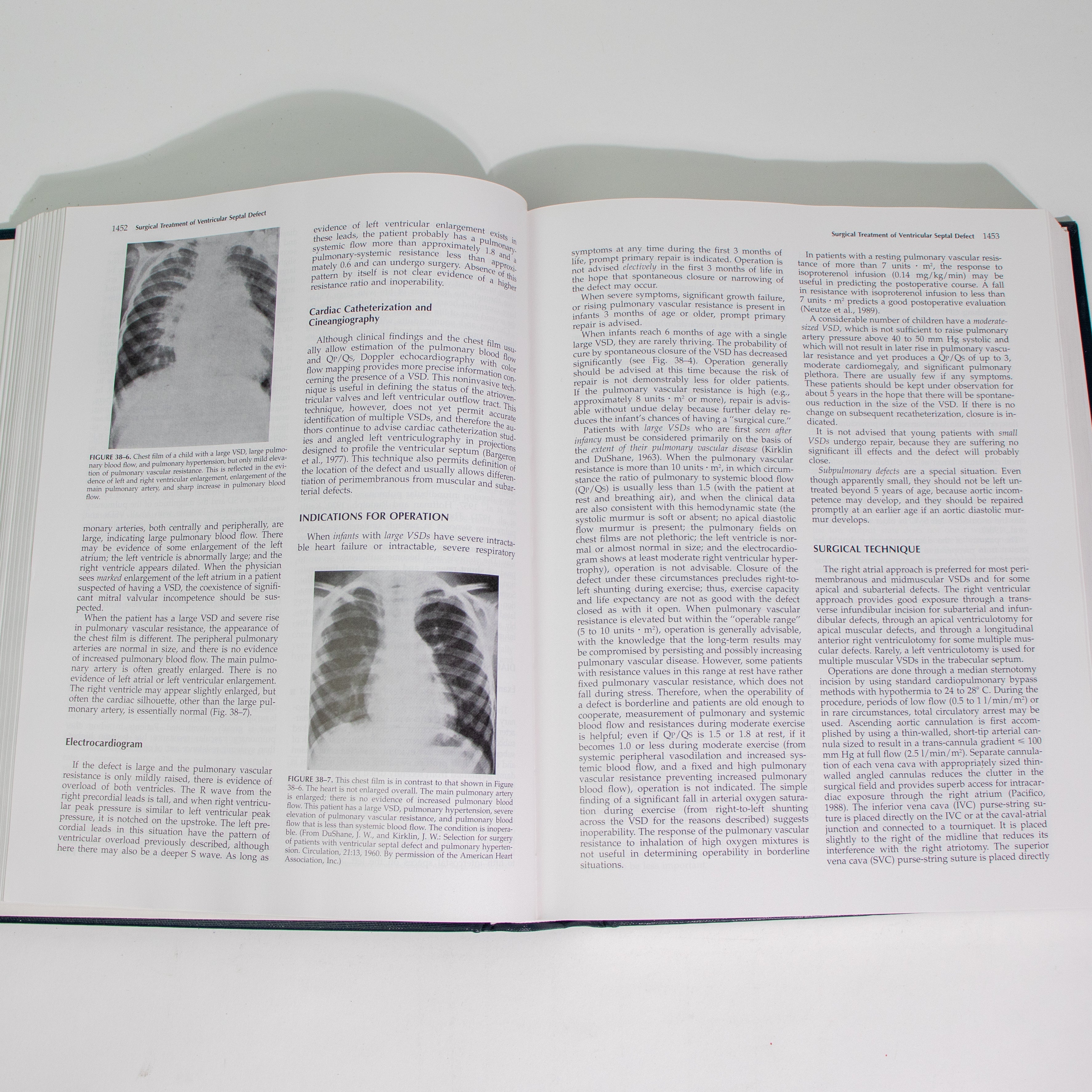Surgery of the Chest, Sixth Edition, Volume II